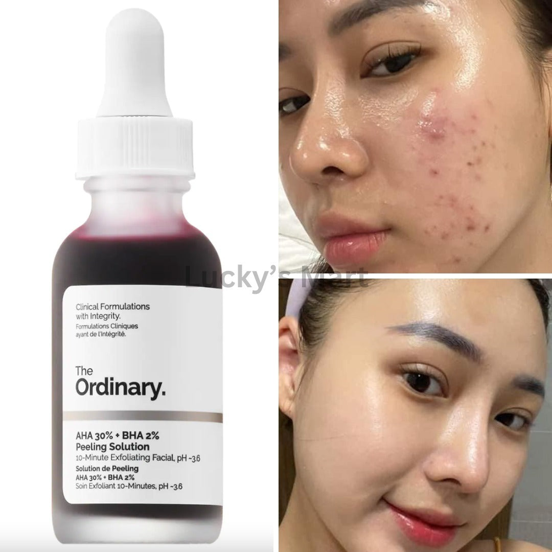 The Ordinary all in 1 skin care set