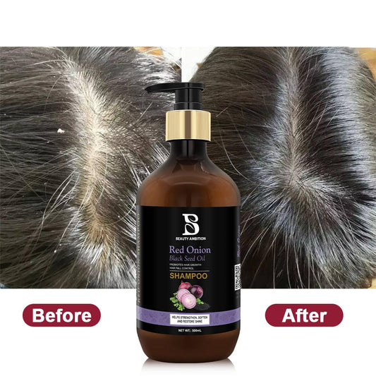 Red Onion & Black Seed Oil Hair Shampoo 4 pcs set with rosemary oil